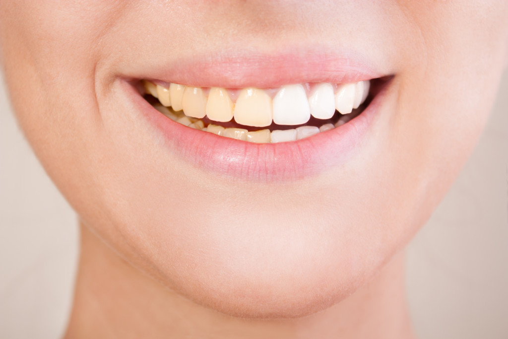 A woman fixing yellowish teeth