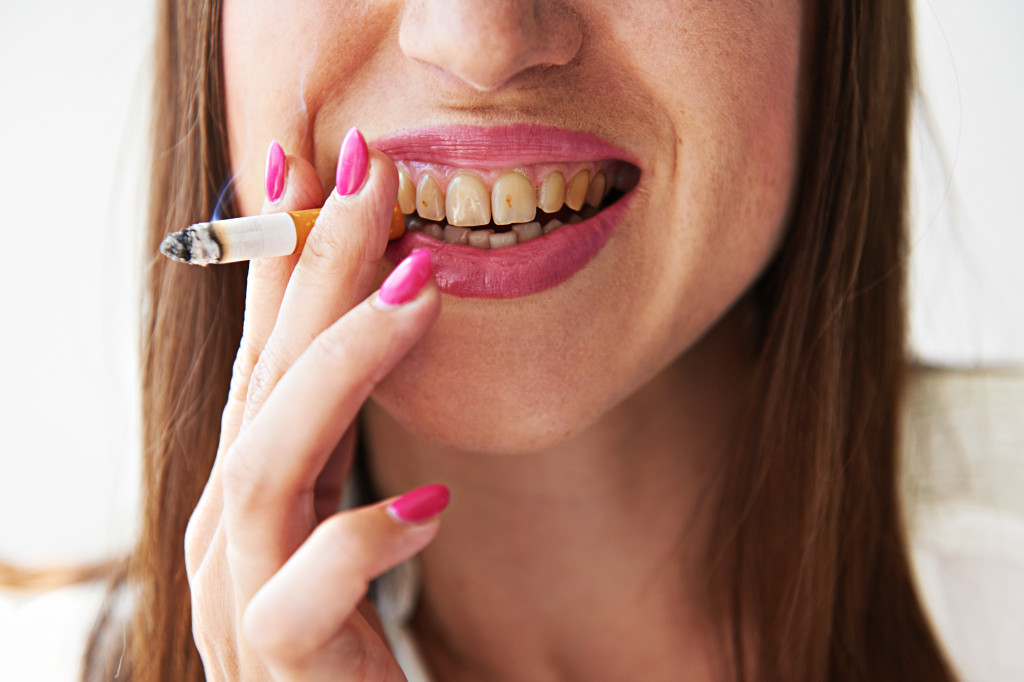 stained teeth due to smoking